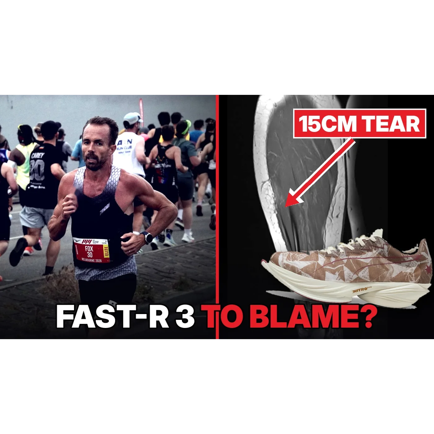 I Tore My Calf at Melbourne Marathon in the Puma Fast-R 3 - Is Valencia Over?