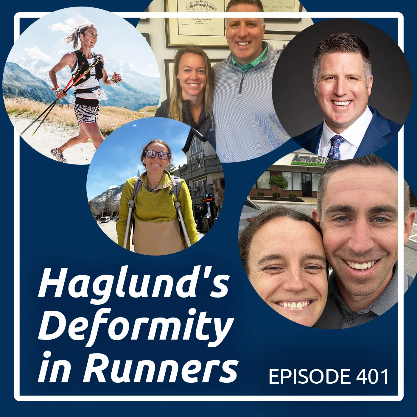 Haglund's Deformity in Runners - R4R 401